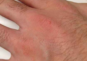 همه چیز درباره "گال"