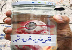 فروش جنجالی‌ قرنیه چشم در مشهد!