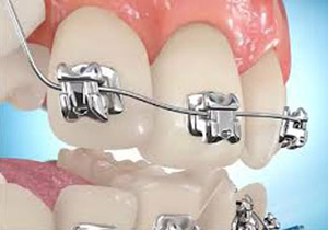 مشکلات ژنتیکی مهمترین عامل ابتلا به بیماری‌های فکی