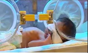کمبود تخت مراقب ویژه نوزادان در بیمارستان ها + فیلم