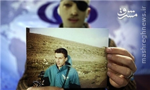 سرگردانی قربانی «اسیدپاشی اشتباهی»