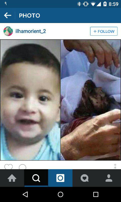 آخرین تصاویر از نوزادی که صهیونیست ها زنده سوزاندند!(18+)
