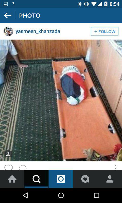 آخرین تصاویر از نوزادی که صهیونیست ها زنده سوزاندند!(18+)