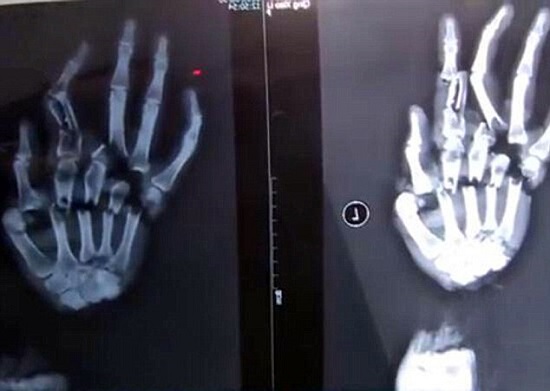 جنایت ورزشکار معروف پس از 30 سال فاش شد/شوهر بی رحم دست همسرش را با ساطور خرد کرد/قتل عام اعضای خانواده توسط پسر 19 ساله +تصاویر