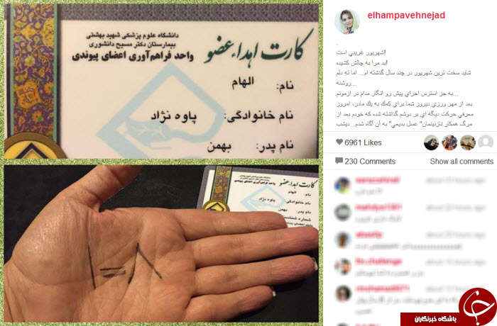 چالش اهدای عضو