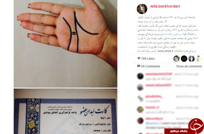 چالش اهدای عضو