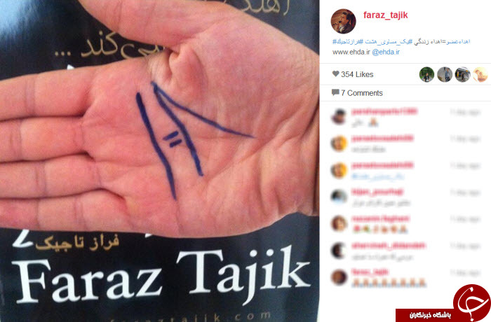 چالش اهدای عضو