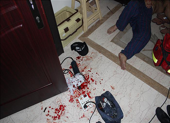 بی احتیاطی مرد صاحب خانه حادثه ساز شد+ تصاویر