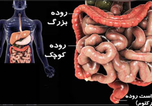 چسبندگی روده‌هایتان را جدی بگیرید