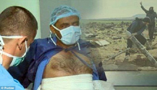 تصاویری تکان دهنده از کاربرد گاز خردل بوسیله داعش