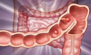 پاکسازی دستگاه گوارش با این خاک معجزه کننده