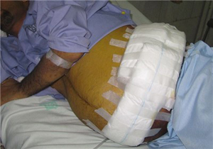 سکوت مرگـــــــــــــــبار در قبال جــــــــــــــــــان ۲۲۶ بیمار