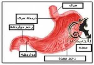 درمان قطعی زخم معده و اثنی عشر؛ بدون دارو!