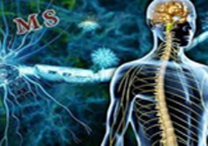 ابتلای 70 هزار نفر به بیماری ام اس درایران