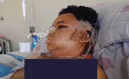 پسر جوان در مبارزه با مرگ+ تصاویر