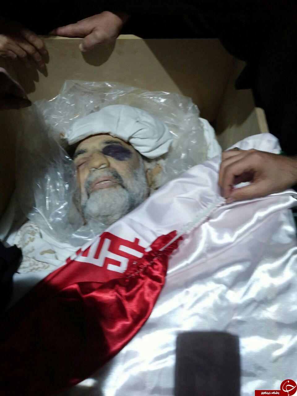 عکس دیده نشده از پیکر مطهر شهید حسین همدانی