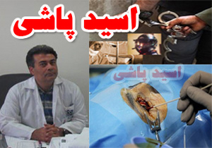 مخالفت پزشکی‌قانونی با قصاص گوش مرد اسیدپاش