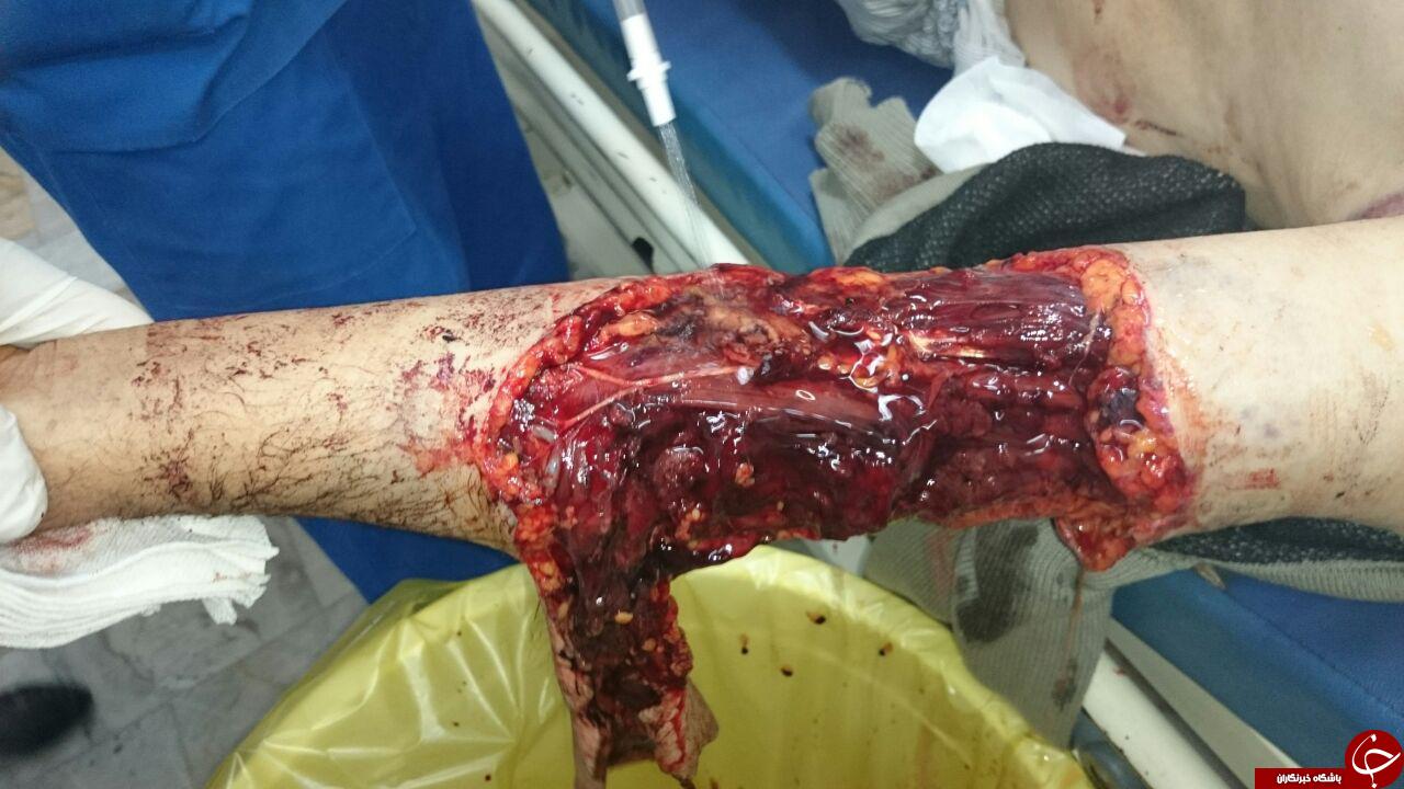نبرد خونین مرد الموتی با یک قلاده خرس + تصاویر (18+)
