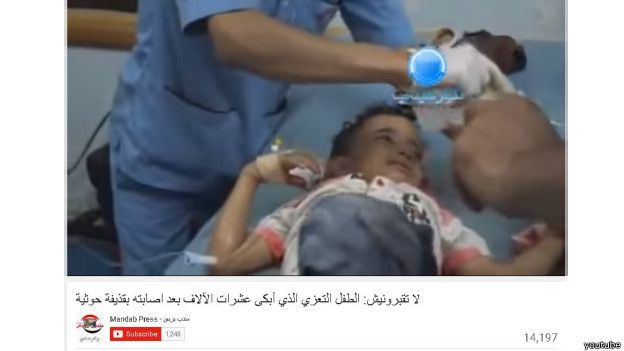 سخنی اندوه&zwnj;بار از یک کودک یمنی: من را دفن نکنید!