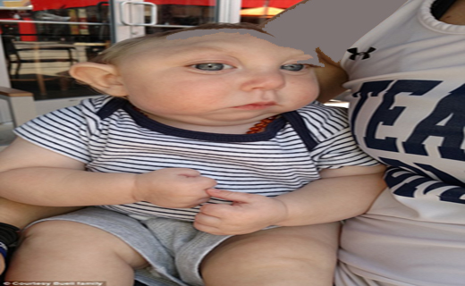 کودکی که با نصف سر یک ساله شد+ تصاویر