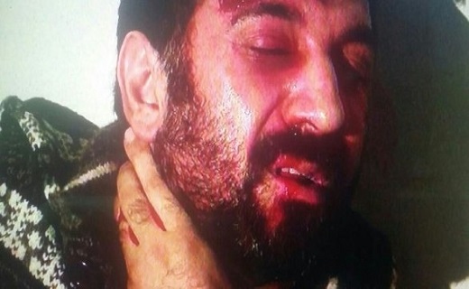 پیکر خون آلود علی انصاریان
