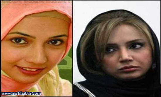 تفاوت چهره بازیگران زن ایرانی، قبل و بعد از عمل زیبایی +تصاویر