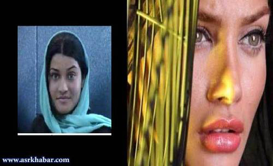 تفاوت چهره بازیگران زن ایرانی، قبل و بعد از عمل زیبایی +تصاویر
