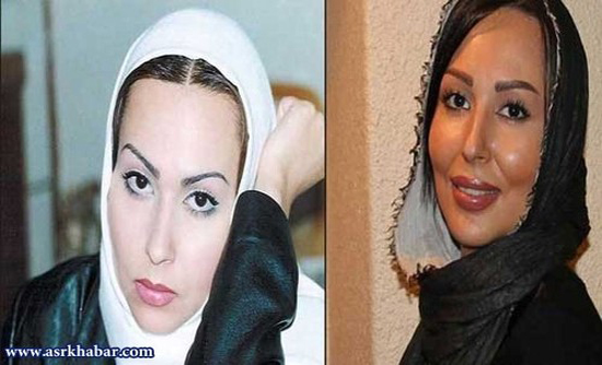 تفاوت چهره بازیگران زن ایرانی، قبل و بعد از عمل زیبایی +تصاویر