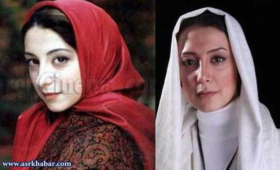تفاوت چهره بازیگران زن ایرانی، قبل و بعد از عمل زیبایی +تصاویر