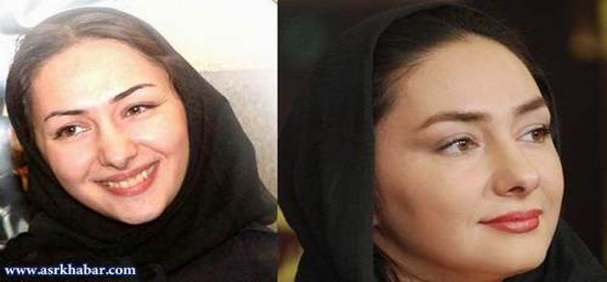 تفاوت چهره بازیگران زن ایرانی، قبل و بعد از عمل زیبایی +تصاویر