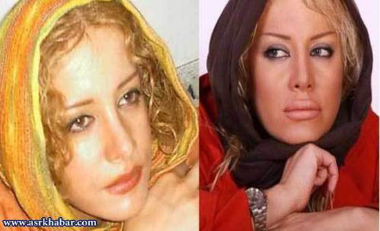 تفاوت چهره بازیگران زن ایرانی، قبل و بعد از عمل زیبایی +تصاویر