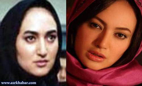تفاوت چهره بازیگران زن ایرانی، قبل و بعد از عمل زیبایی +تصاویر