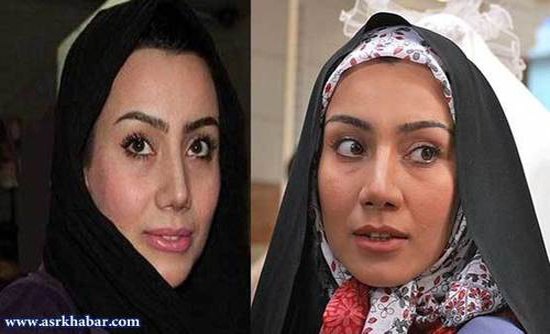 تفاوت چهره بازیگران زن ایرانی، قبل و بعد از عمل زیبایی +تصاویر