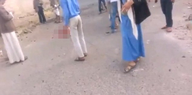 جان سختِ داعشی پس از عملیات انتحاری زنده ماند! + تصاویر  (16+)