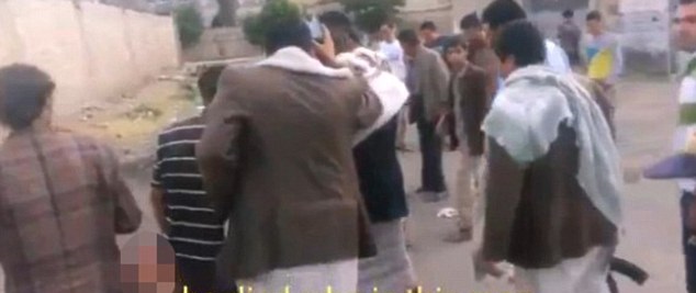 جان سختِ داعشی پس از عملیات انتحاری زنده ماند! + تصاویر  (16+)