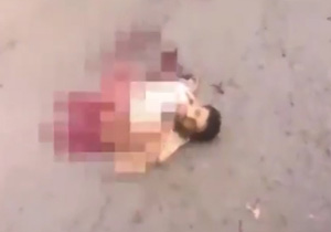 یک داعشی، با وجود دو نیم شدن بدن زنده ماند! + فیلم(18+)