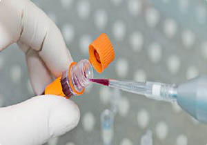 تلاش محققان ایرانی برای استخراج DNA‌ جنین از خون مادر