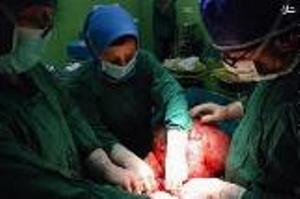 خارج شدن غده 12 کیلویی از شکم یک بیمار در رشت