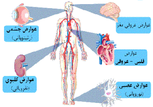 وجود 17 هزار دیابتی در رفسنجان