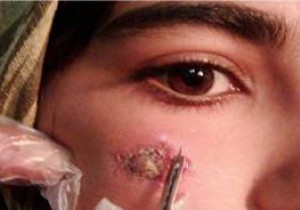 برای مهار بیماری سالک باید اقدام اساسی صورت گیرد
