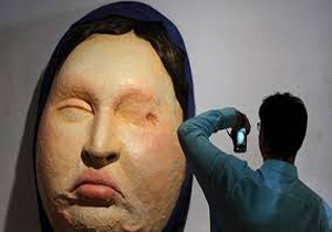 مادر بر روی دختر اسید پاشید
