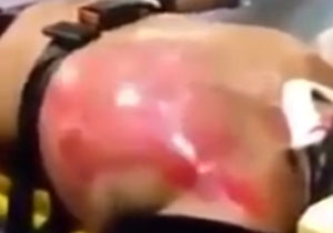 قلب در حال انفجار این جوان با مصرف بیش از 18 نوع مواد انرژی زا + فیلم