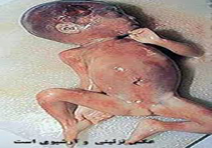 کشف «جنین» در پارک مشیریه