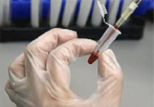 انجام 95 درصدآزمایشها در بیمارستان‌های دولتی قزوین
