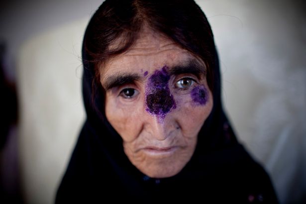شیوع بیماری مرگبار 