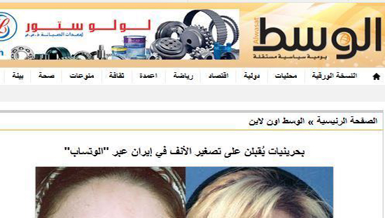 اقبال دختران و زنان بحرینی و کویتی به عمل زیبایی بینی در ایران با 