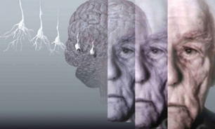 مقایسه پیرشدن مغز مردان نسبت به زنان