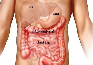12 روش برای پیشگیری از سرطان روده