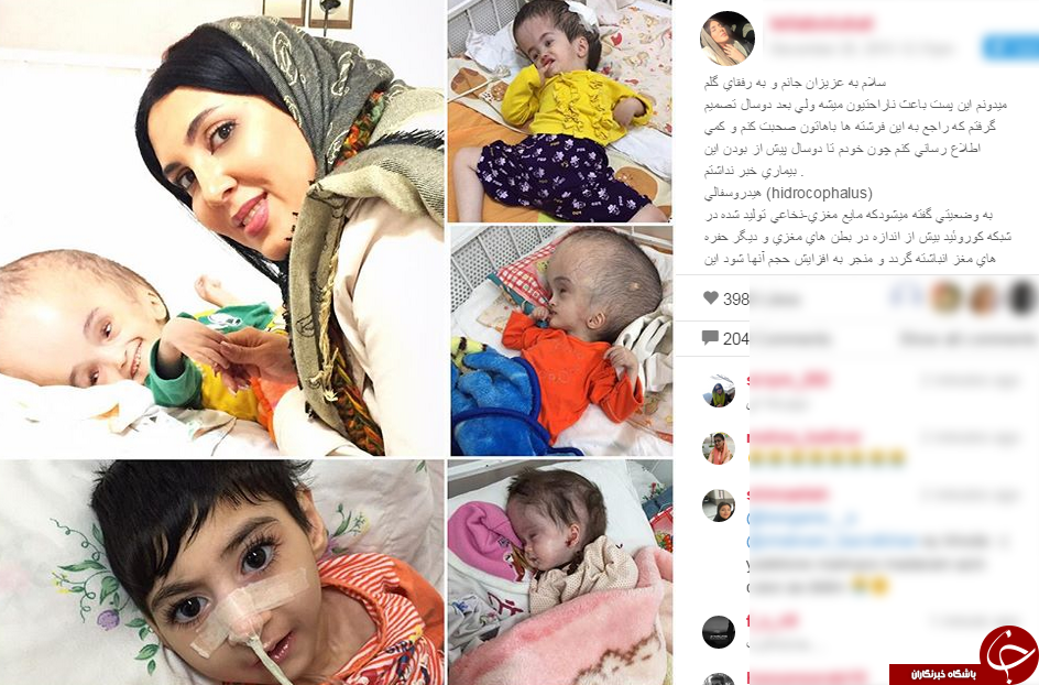 عیادت لیلا بلوکات از کودکان هيدروسفالي + اینستاپست