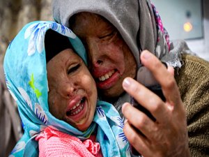 اسید پاشی؛نیازمند برخورد قانونی یا اقدامات فرهنگی؟/ علل جرم اسید پاشی از منظر جامعه شناسان